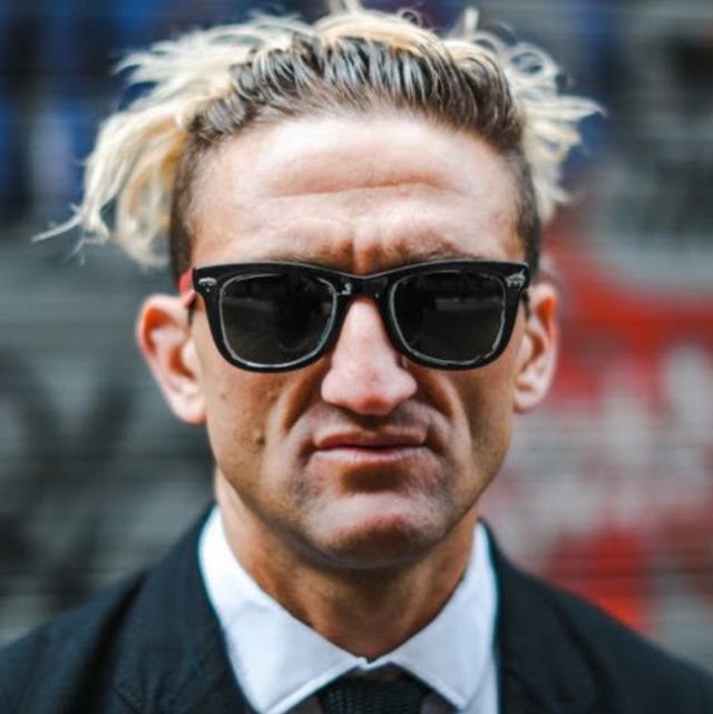 The hairline of Casey Neistat