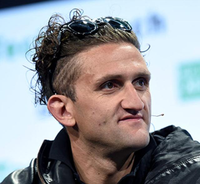 The hairline of Casey Neistat