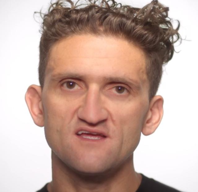 The hairline of Casey Neistat