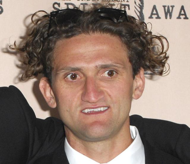 The hairline of Casey Neistat