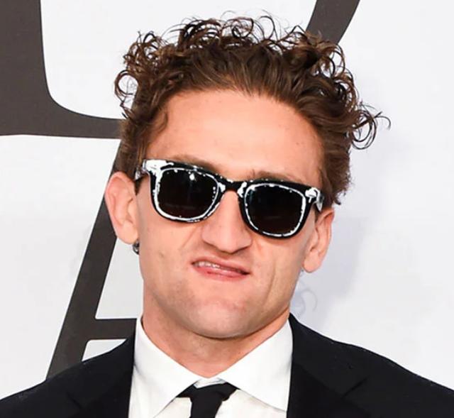 The hairline of Casey Neistat