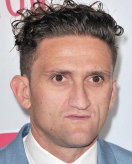 The hairline of Casey Neistat