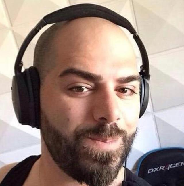 The hairline of Daniel Keem