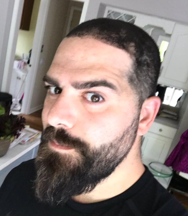 The hairline of Daniel Keem