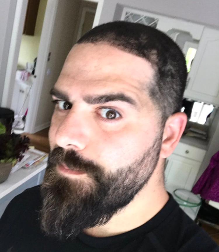 The hairline of Daniel Keem