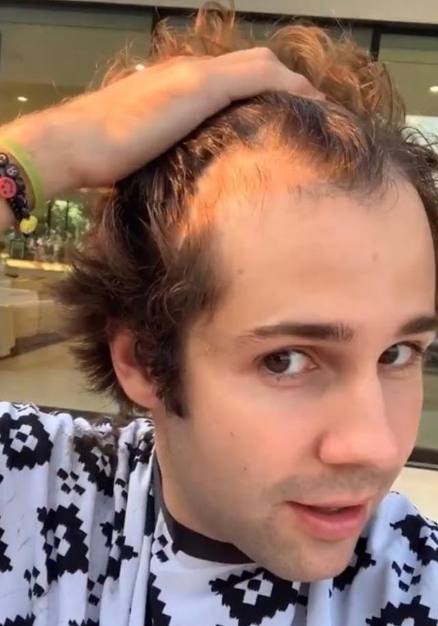 The hairline of David Dobrik