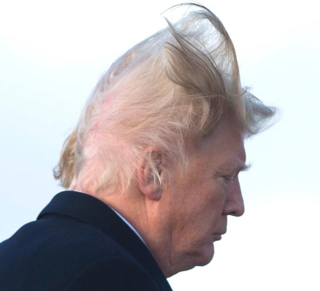 The hairline of Donald Trump