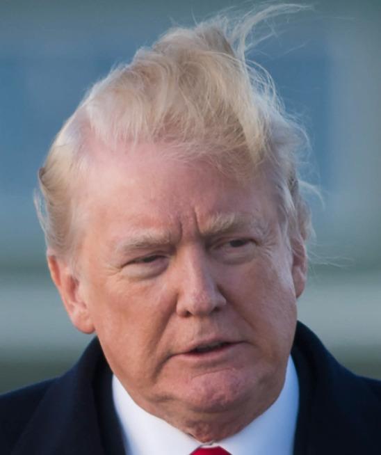 The hairline of Donald Trump