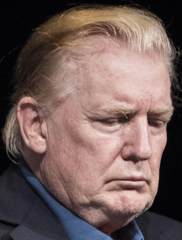 The hairline of Donald Trump