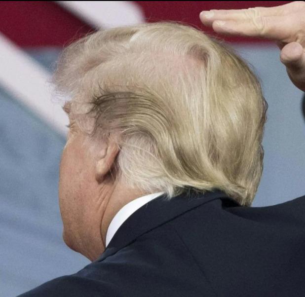 The hairline of Donald Trump