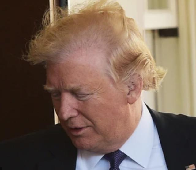 The hairline of Donald Trump