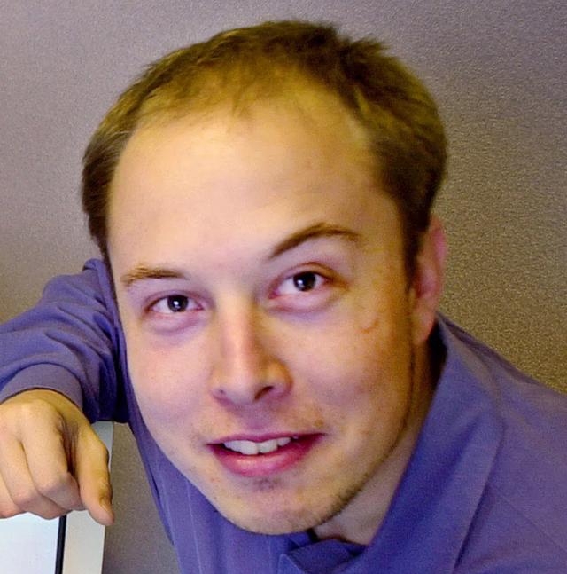 The hairline of Elon Musk