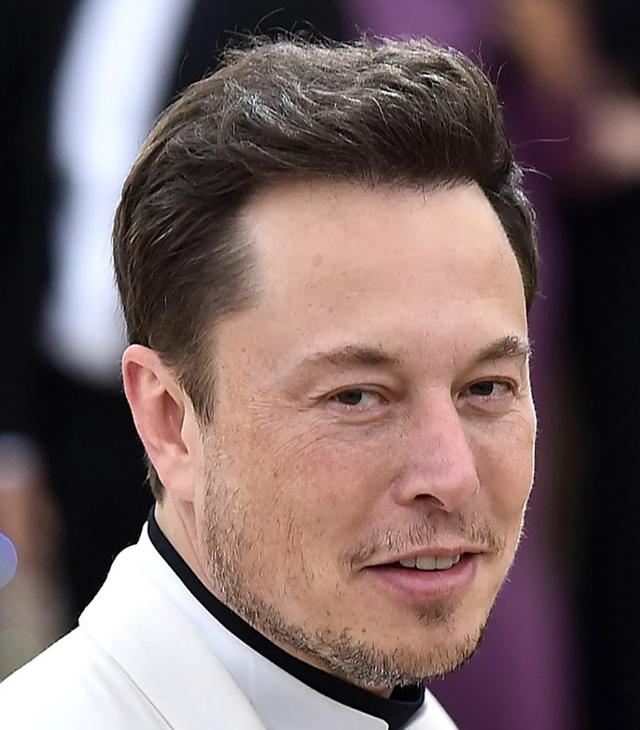 The hairline of Elon Musk