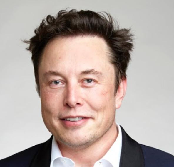 The hairline of Elon Musk