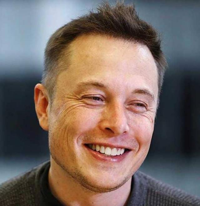 The hairline of Elon Musk