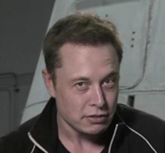 The hairline of Elon Musk