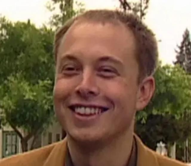 The hairline of Elon Musk