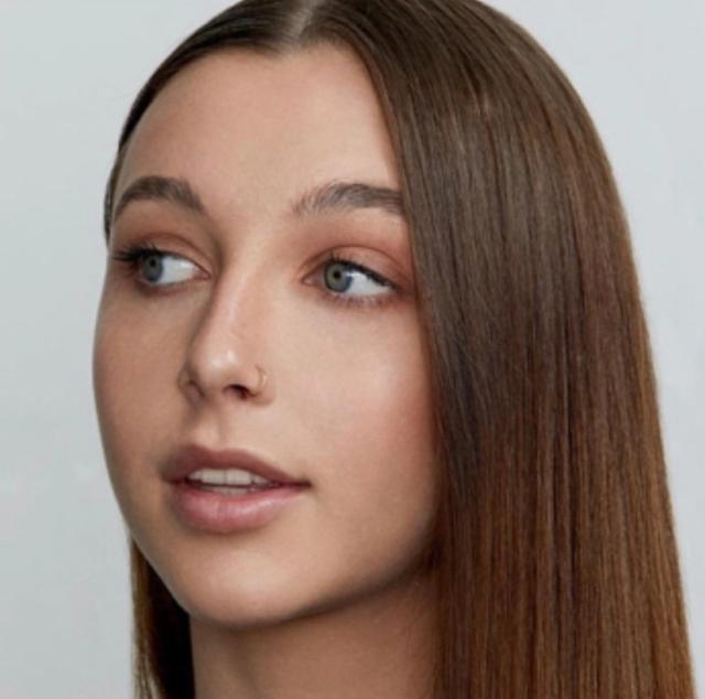 The hairline of Emma Chamberlain