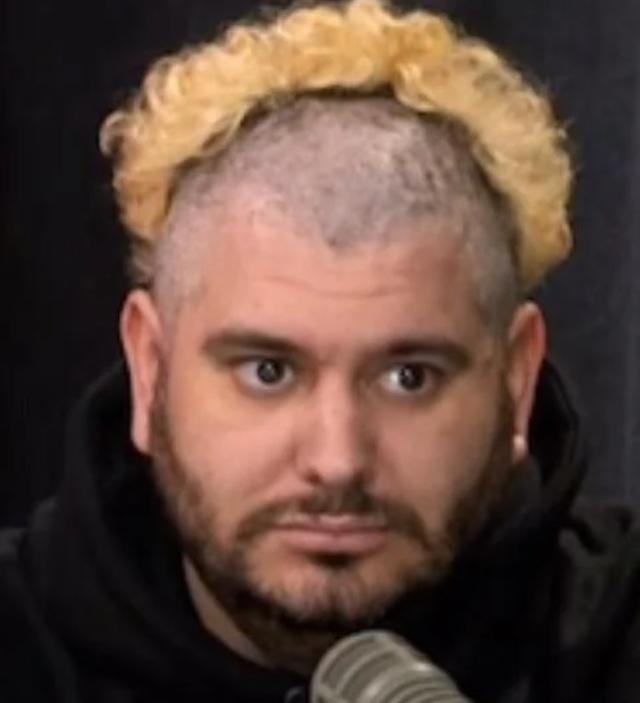 The hairline of Ethan Klein