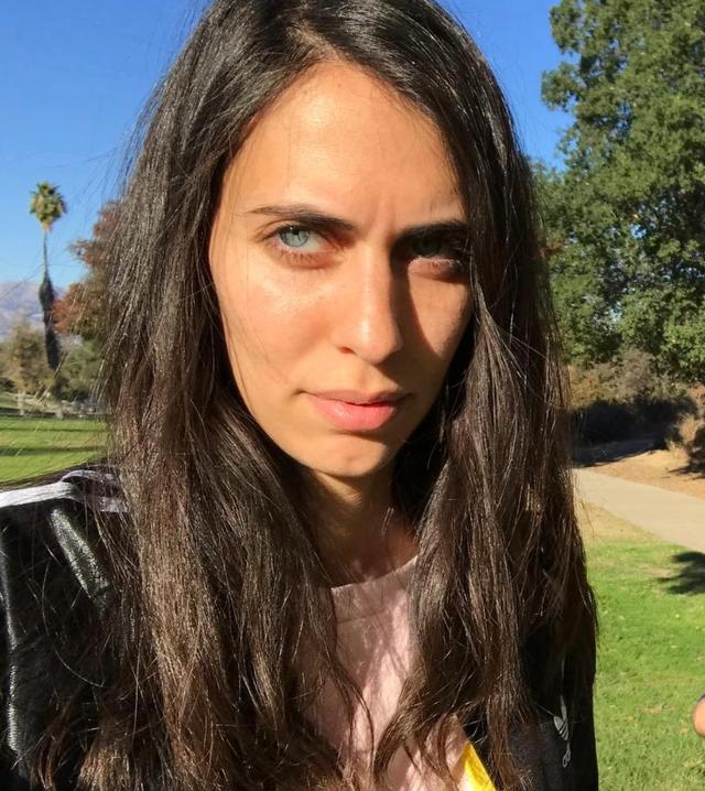 The hairline of Hila Klein