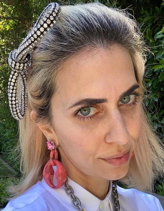 The hairline of Hila Klein