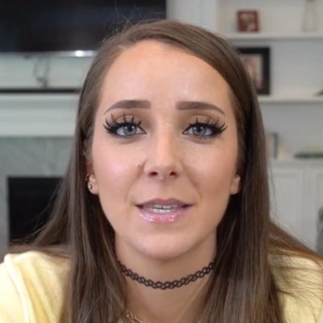 The hairline of Jenna Marbles