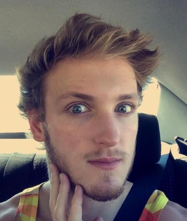 The hairline of Logan Paul