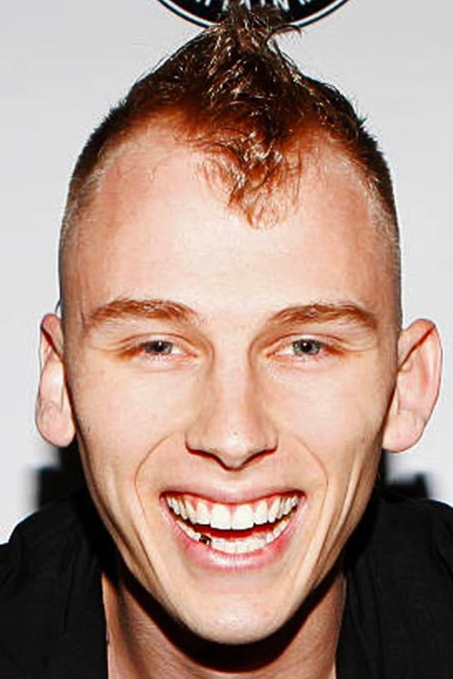 The hairline of Machine Gun Kelly