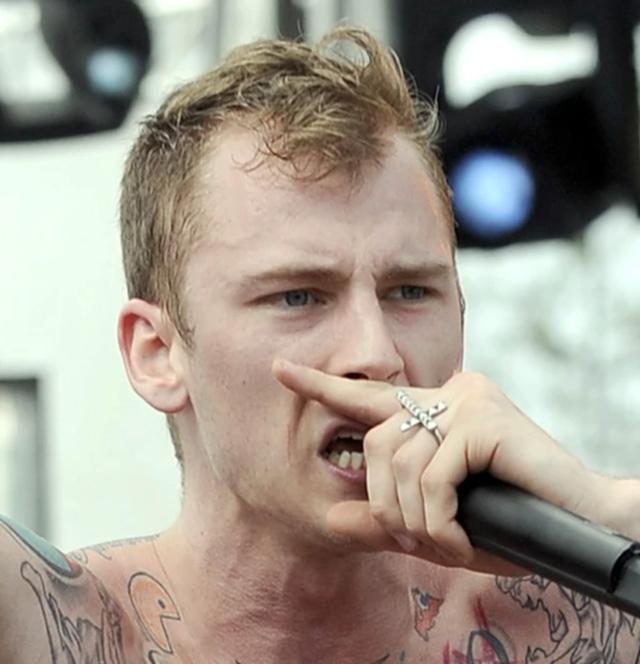 The hairline of Machine Gun Kelly