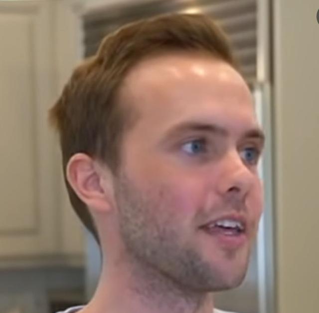 The hairline of Ryland Adams