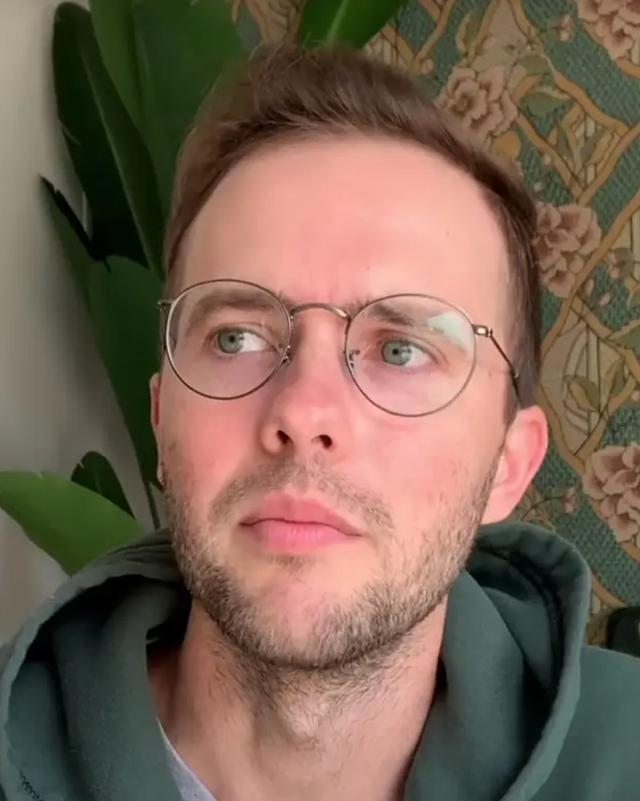 The hairline of Ryland Adams