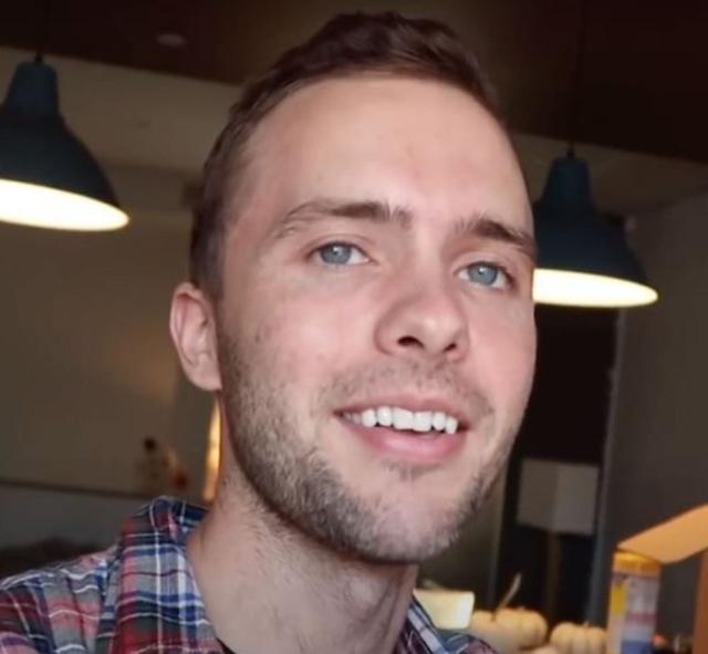 The hairline of Ryland Adams