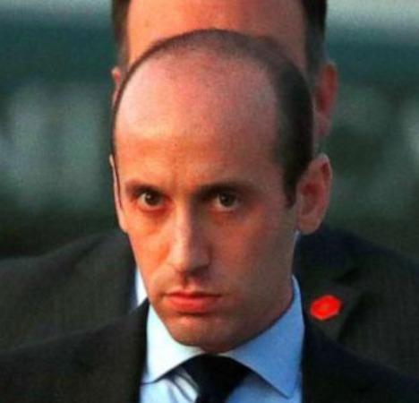 The hairline of Stephen Miller