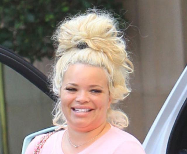 The hairline of Trisha Paytas