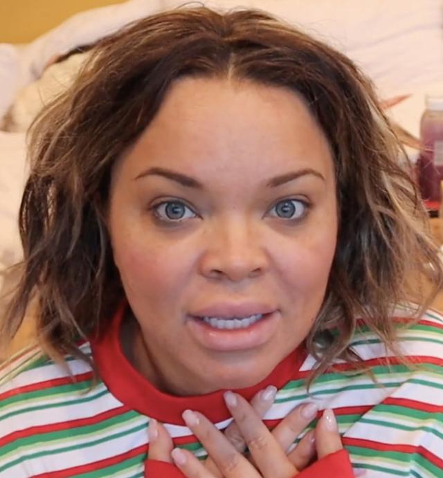 The hairline of Trisha Paytas