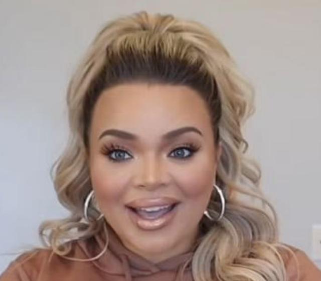 The hairline of Trisha Paytas