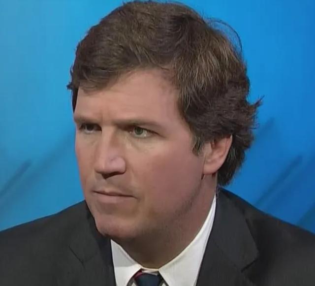 The hairline of Tucker Carlson