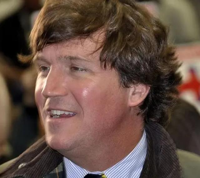 The hairline of Tucker Carlson